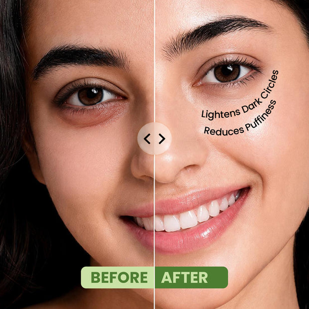 Hydra Eye Serum Patch with Aloe Vera